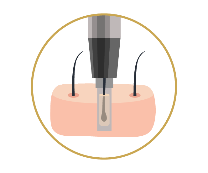 Consulta inicial — Dr. De Felipe