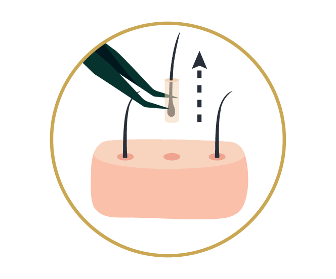 Diseño de la línea capilar